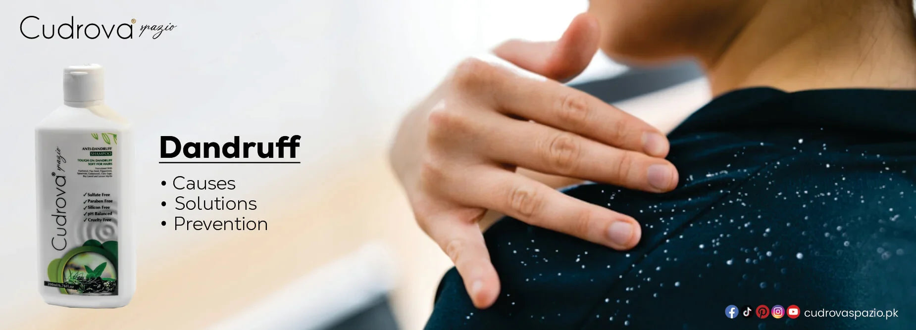 Dandruff: Causes, Treatment, and Tips for a Flake-Free Scalp