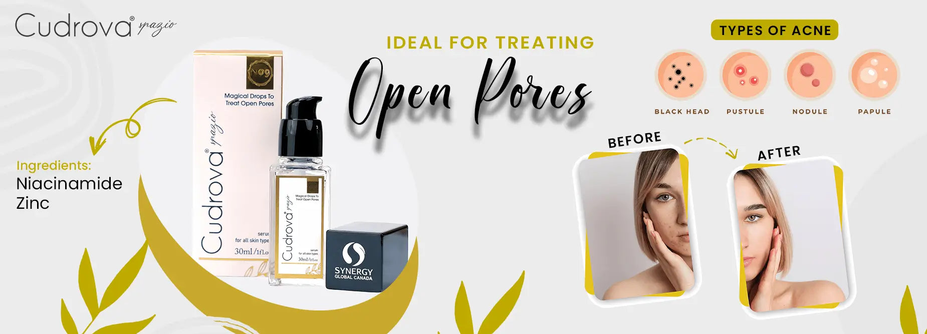 Open Pores: Causes and How Serums Can Help Treat Them